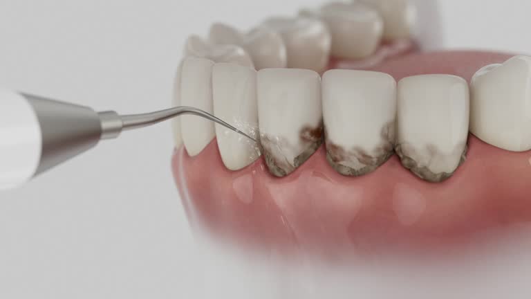 Reliable Tooth Extraction contractor in Lanier County County, GA by Dentist Open Now
